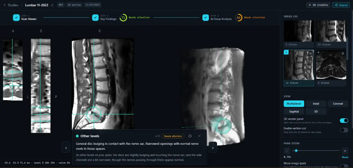 Read Your Scan screenshot 3