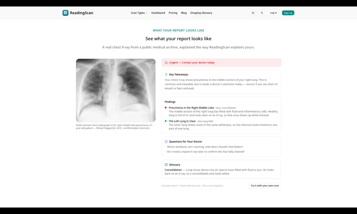 ReadingScan screenshot 2